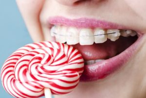 http://www.oralb.com/embraceit/what-you-can-eat-with-braces