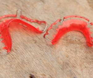 What are the Different Types of Retainers?