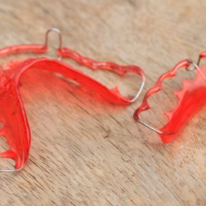 What are the Different Types of Retainers?